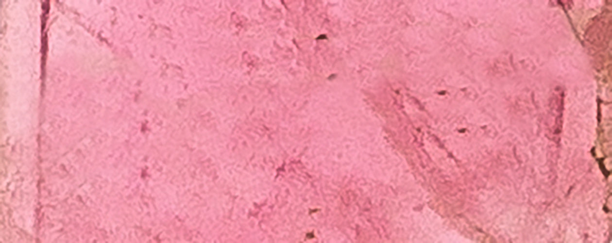Tourmaline